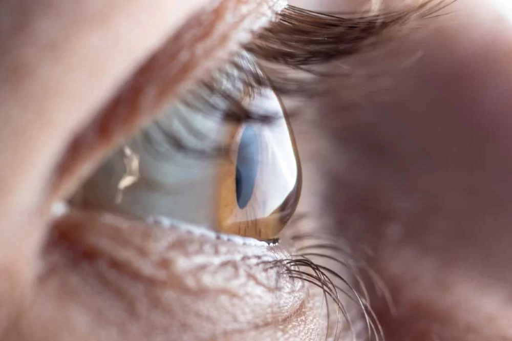 Understanding Astigmatism: Causes, Symptoms, and Treatment Options for Better Vision