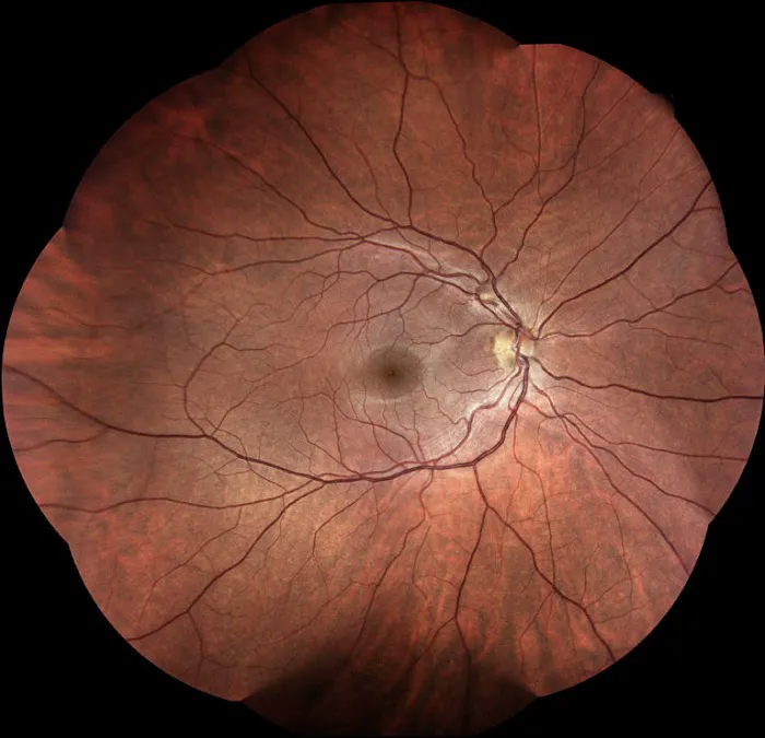 EYE INSTITUTE OF CENTRAL NJ 4
