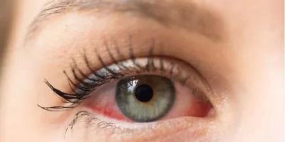 Emergency Eye Care Services in Los Angeles for Immediate Attention