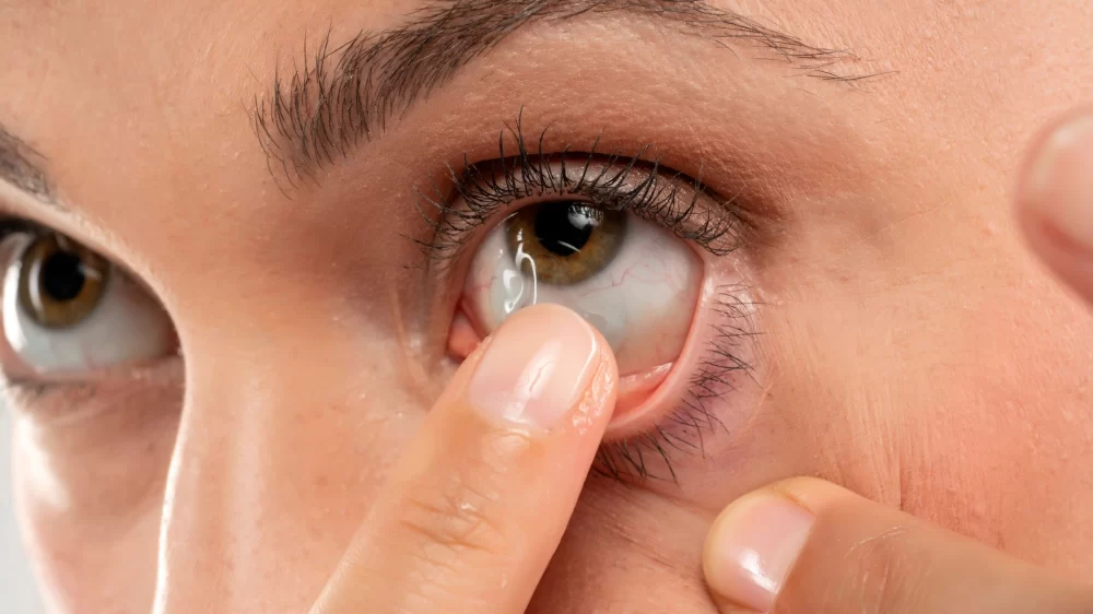 Expert Contact Lens Fitting for Perfect Vision: Your Comprehensive Guide