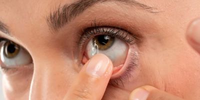 Expert Contact Lens Fitting for Perfect Vision: Your Comprehensive Guide
