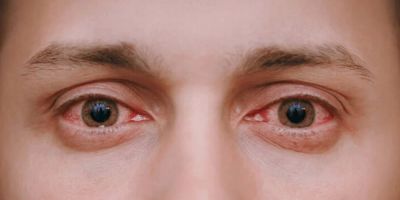 Symptoms of Eye Diseases and When to Seek Help