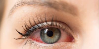 Signs of Eye Problems That Require Medical Attention: A Comprehensive Guide