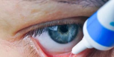 How to Manage Dry Eyes with Natural Remedies: Simple and Effective Solutions