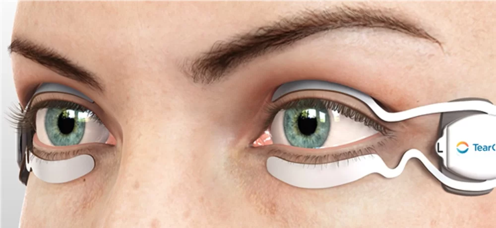 How to Find the Best Eye Doctors for Effective Dry Eye Treatment