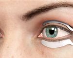 How to Find the Best Eye Doctors for Effective Dry Eye Treatment