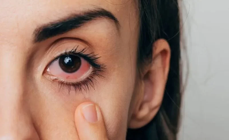 How to Handle Eye Emergencies Quickly and Safely