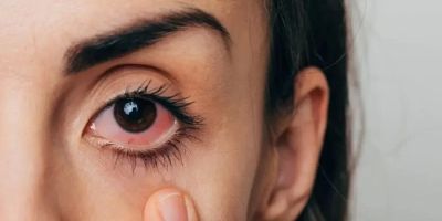 How to Handle Eye Emergencies Quickly and Safely