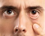 Causes of Blurry Vision and When to Seek Help