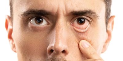 Causes of Blurry Vision and When to Seek Help