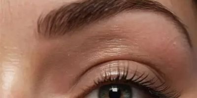 Natural Remedies for Eye Redness: Effective Solutions You Can Try