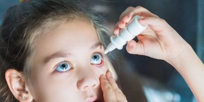 How to Treat Viral Eye Infections Effectively with Medications and Care